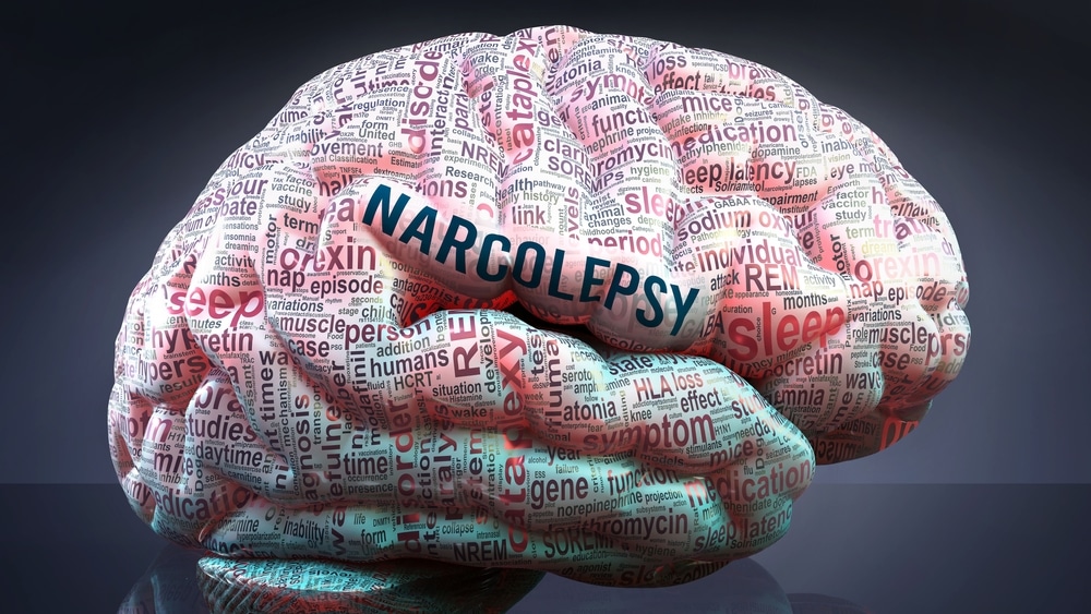 Narkolepsija